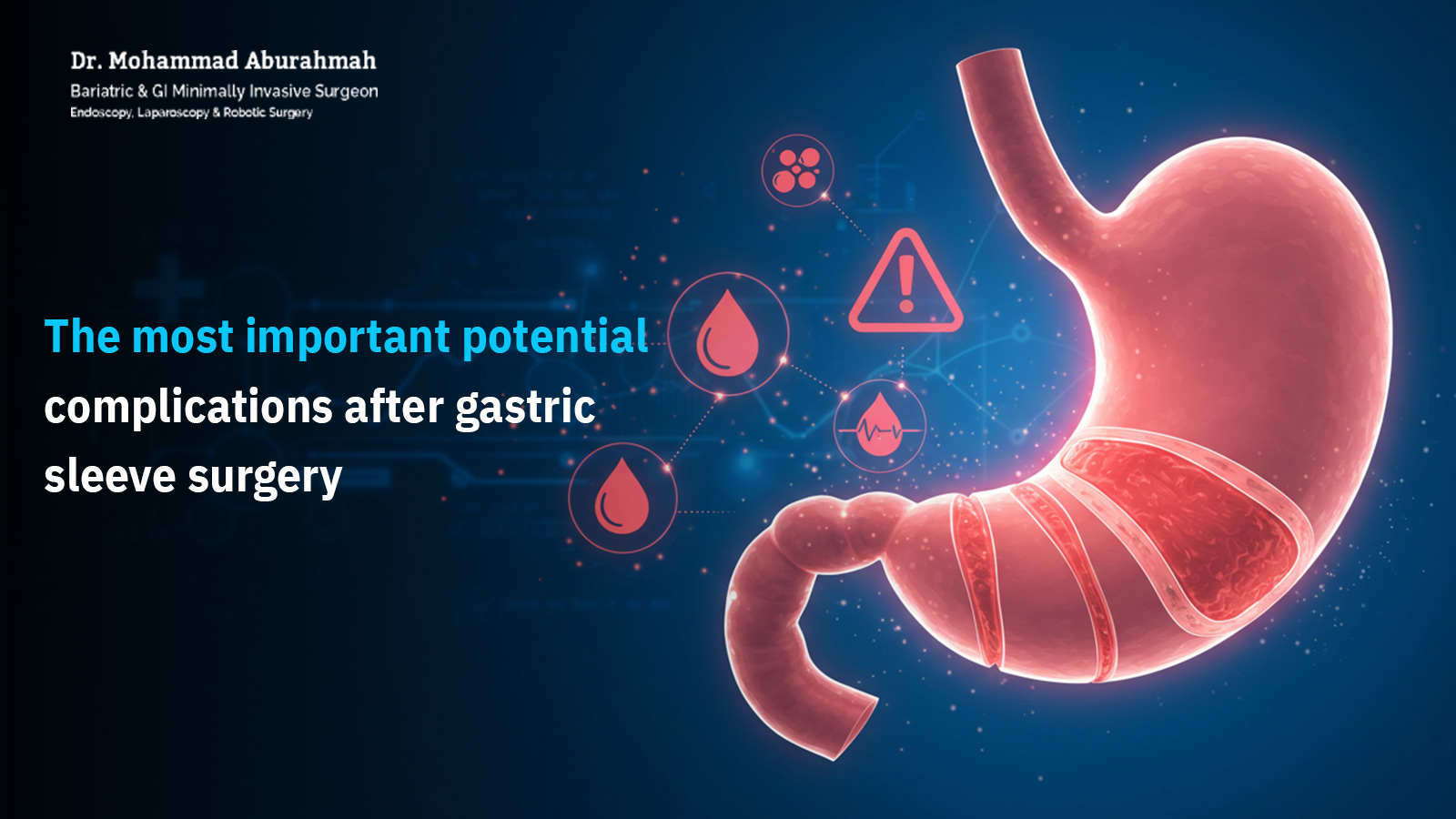 Gastric Sleeve Surgery